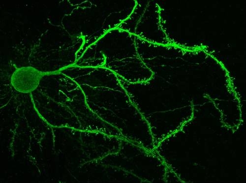 Una neurona estrial de la vía directa.Foto CSIC